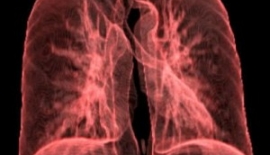 Addison Hastalığı