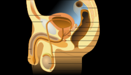 Adult Hipospadias Ve Epispadias