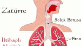 Akciğer Apseleri Nedir?