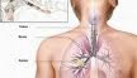 Akciğer Kistleri Nasıl Tedavi Edilir?