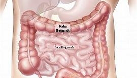 Akut Ve Kronik Kolit