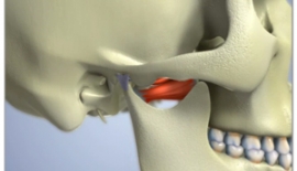 Alt Çene Kemiği Yüz Kırığı