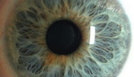 Astigmat Belirtileri