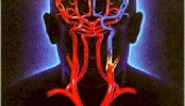 Beyin Damarlarında Tıkanma