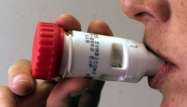 Bronşial Astma Alerjik Astım