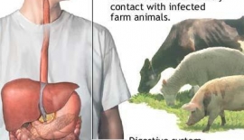 Brucella Bruselloz Malta Humması