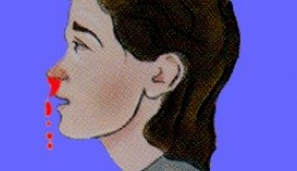 Burun Kanamaları Nasıl Kontrol Altına Alınabilir?