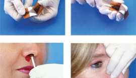 Burun Kanamasında Tamponun Süresi