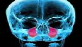 Burun Ve Sinüs Tümörleri