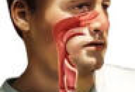 Allerjik Rinit (allerjik Nezle) Nedir?