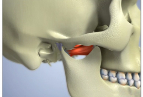 Alt Çene Kemiği Yüz Kırığı