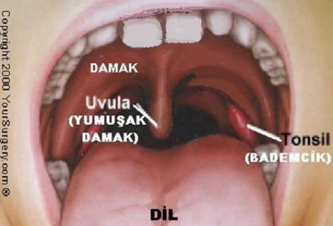 Bademcik İltihapları