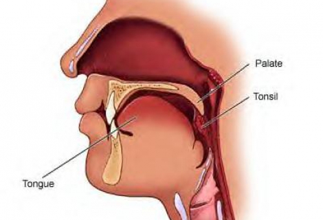 Bademciklerin ve Adenoitlerin Alınması