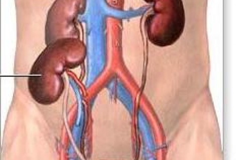 Böbrek Nakli Nedir?