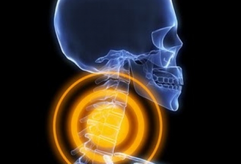 Boyun Ağrısı Boyun Fıtığı