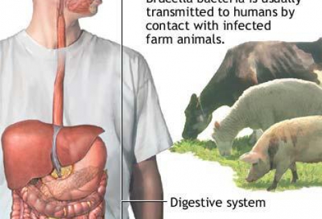 Brucella Bruselloz Malta Humması