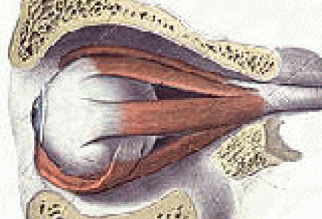 Zehirli Guatr