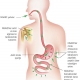 Artritin Tedavisinde Kortizonun Rolü Nedir?