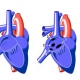 Atrial Septal Defekt Asd Çocukta