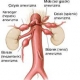 Barsak Damar Tıkanıklığı