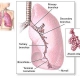 Byssinosis Nedir?