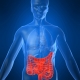 Crohn Hastalığı Belirtileri