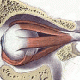Zehirli Guatr