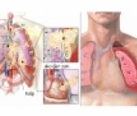 Akciğer Kanseri Tedavisi