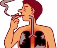 Akciğer Kanserinin Gelişmekte Olduğu Nasıl Anlaşılabilir?