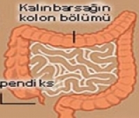 Apandisit Nasıl Oluşur?
