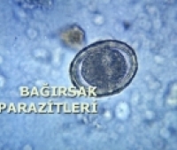 Barsak Parazitleri