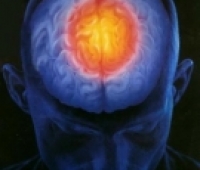 Başağrısı Ve Migren