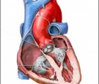 Bypass Ameliyati