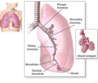 Byssinosis Nedir?