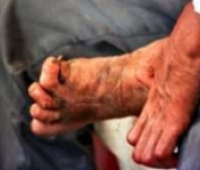 Cüzzam Neden İleri Gelir?
